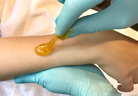 Sugaring Behandlung an den Armen